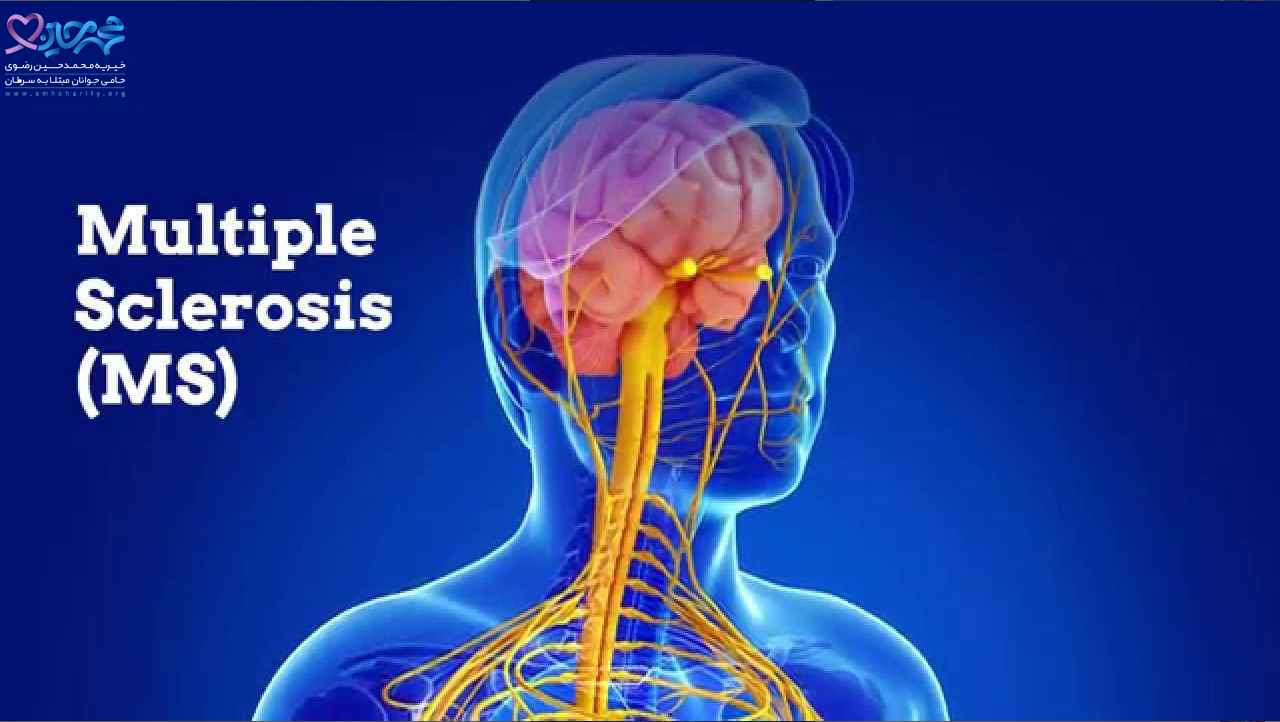 Склероз на английском. Multiple Sclerosis. Рассеянный склероз картинки. MS disease. Рассеянный склероз клетки.